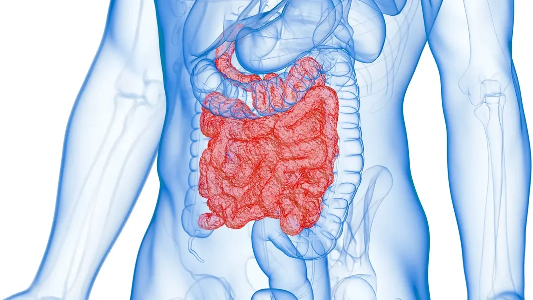 Nova čudesna dijeta mogla bi pomoći desetinama hiljada Mađara