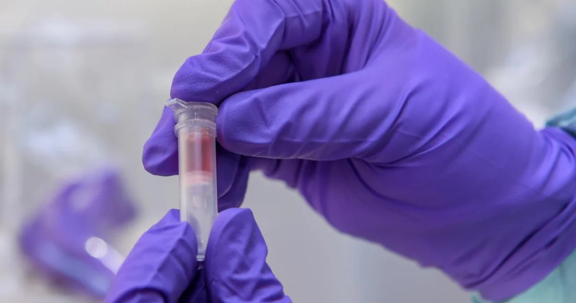 Širi se opasna gljivica: Može biti smrtonosna, otporna je na lekove, hiljade su se zarazile