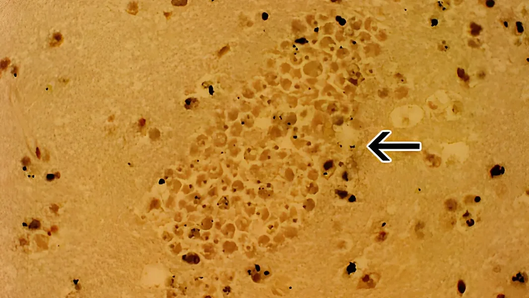 Pijaća voda može postati životno opasna – šokantno upozorenje stiglo