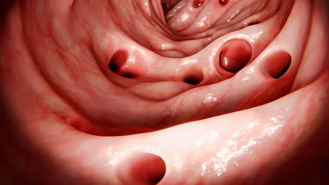 Ova bolest će zahvatiti gotovo svakoga – evo kako možemo da se pripremimo za nju