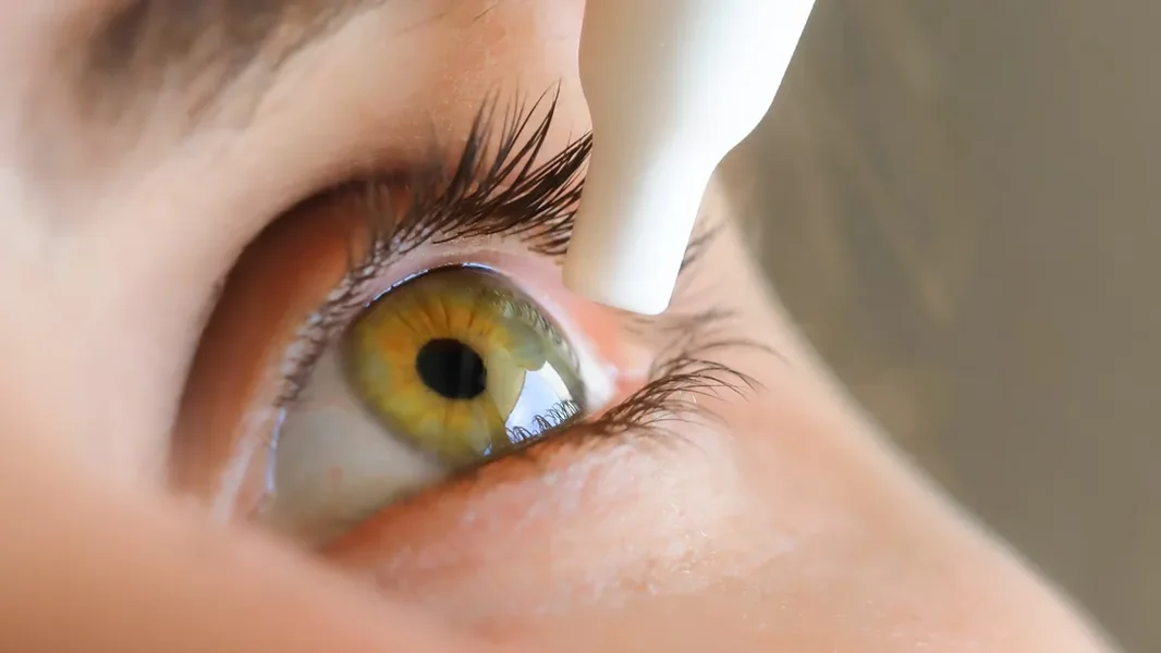 Ogroman problem ako primetite ovo na oku - ORIGO