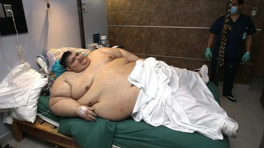 Tragično je umro najdeblji čovek na svetu koji je imao više od 600 kilograma