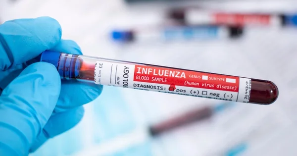 Prva smrt od gripa ove sezone: žena od 88 godina iz Kluž-Napoke, nevakcinisana. Broj slučajeva se udvostručio za nekoliko dana.