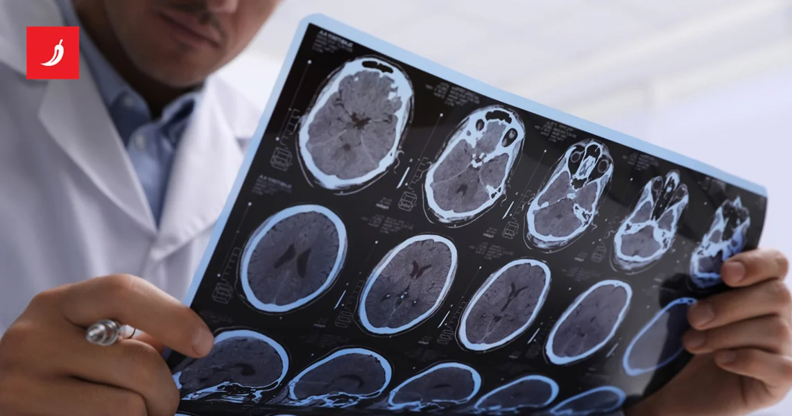 Mozak naglo stari u tri ključne dobi