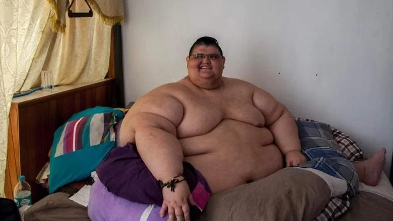 Meksiko, umro najdeblji čovek na svetu: Juan Pedro Franco je težio 600 kg - Shqiptarja.com