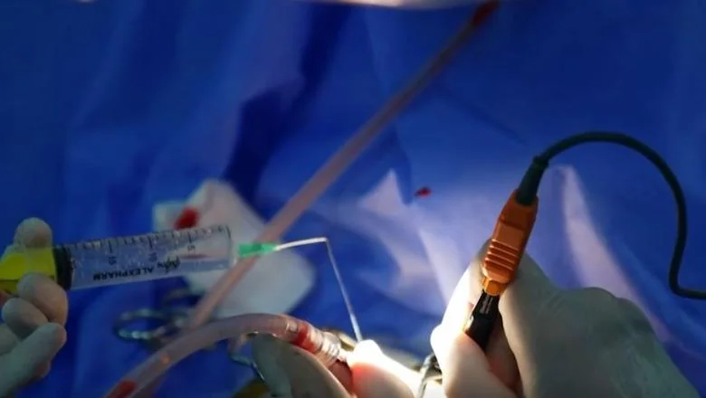 Lekari QSUT uspešno izvedu operaciju kod trogodišnje devojčice! Uklanjaju tumor u mozgu - Shqiptarja.com